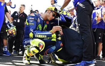 Breaking Leg News, Valentino Rossi: Updated 1 Sep. 0:10, Italy Time